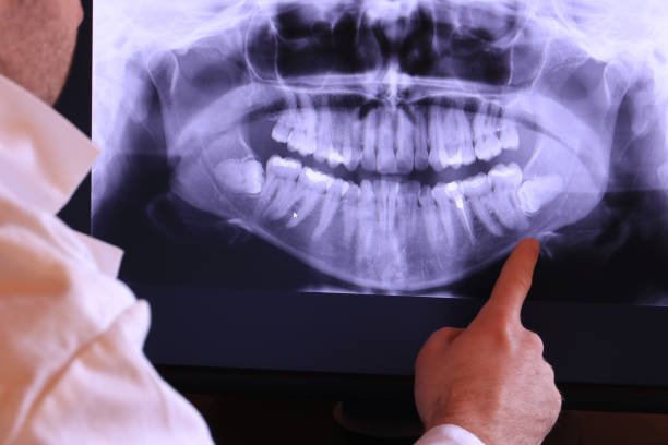 Best Emergency Dental Filling Replacement  in The Village Of Indian Hill, OH